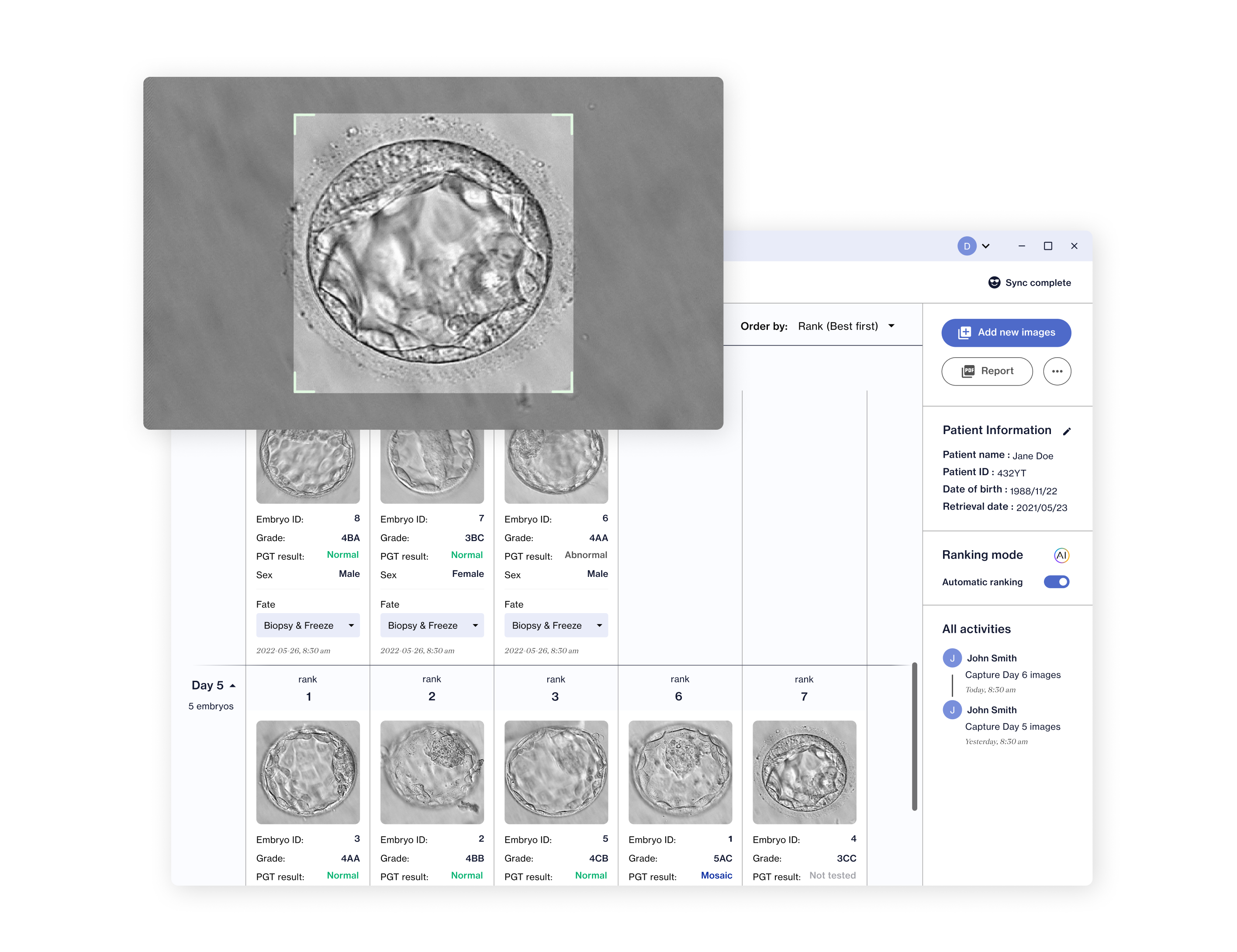 Embryo Assist